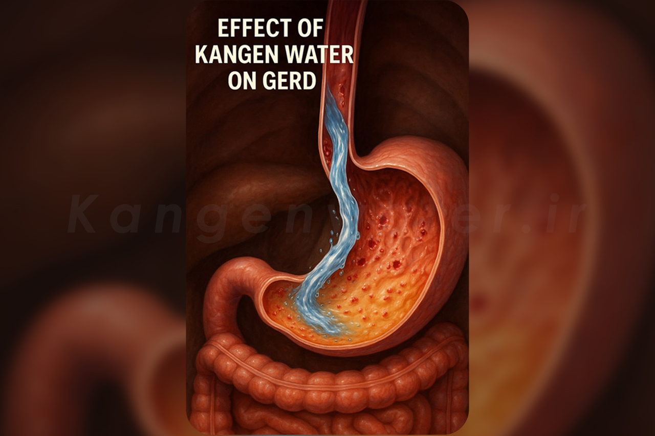 ریفلاکس معده